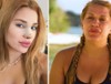 Survivor Almeda Baylan estetik yaptırdı