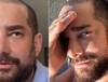 Saç protezini çıkaran Enis Arıkan'a Cengiz İmren benzetmesi!