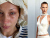 Bella Hadid, Lyme hastalığıyla mücadelesini anlattı