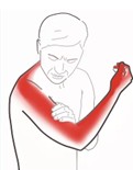 El uyuşması neden olur? El uyuşması nasıl geçer? 7 soruda el uyuşması - Resim : 4