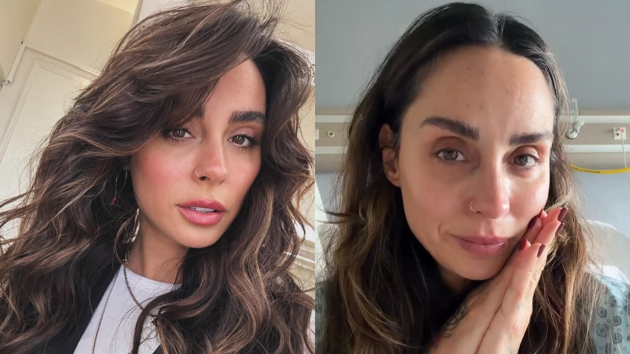 Yasemin Yürük yaşadığı talihsiz kazanın ardından sağlık durumuna dair son gelişmeleri paylaştı: 