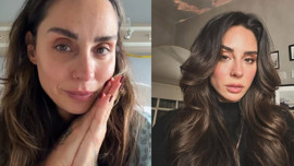 Yasemin Yürük hastaneden son durumunu paylaştı: "His kaybı var!"