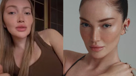 Danla Bilic ameliyatını anlattı