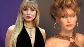 Jennifer Lawrence hakkında 30 bin dolarlık estetik iddiası