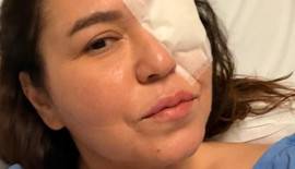 'Estetik operasyonundan kornea nakline uzanan 3,5 yıl'