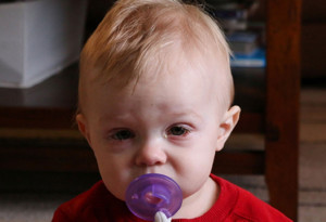 Bebek ve çocuklarda göz nezlesi neden olur? Bulaşıcı mıdır?