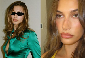 Hailey Bieber yüzüne yaptırdığı işlemleri açıkladı