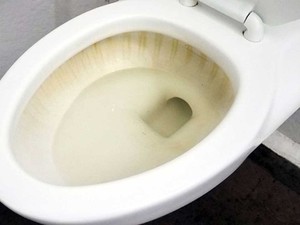 Tam tembel işi: 2 malzeme ile sararmış klozet bembeyaz oluyor