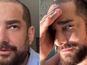 Saç protezini çıkaran Enis Arıkan'a Cengiz İmren benzetmesi!