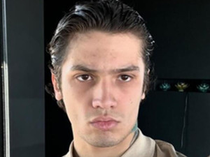Rapçi Çakal havalı tüfekle ayağından vuruldu