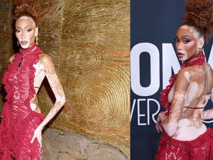 'Vitiligolu model' Winnie Harlow kırmızı halının gözdesi oldu