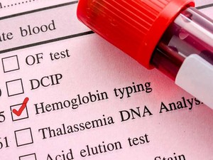 HGB nedir? Hemoglobin kan tahlili neden yapılır?