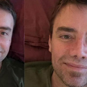 13. kez burun ameliyatı olan Murat Dalkılıç'ın son hali