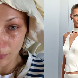 Bella Hadid, Lyme hastalığıyla mücadelesini anlattı