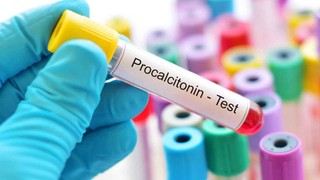 Prokalsitonin (PCT) nedir? Prokalsitonin neden bakılır? Prokalsitonin değeri kaç olmalı?