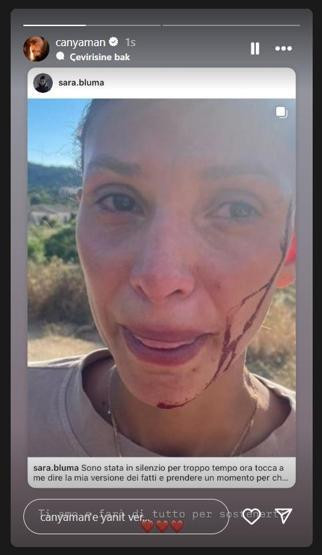 Can Yaman'ın sevgilisi Sara Bluma, çocuğunun babasından şiddet gördüğünü açıkladı - Resim : 3