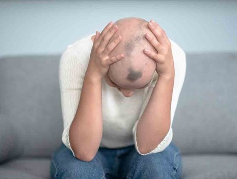 Saçkıran (Alopesi areata) nedir? Saçkıran belirtileri neler?