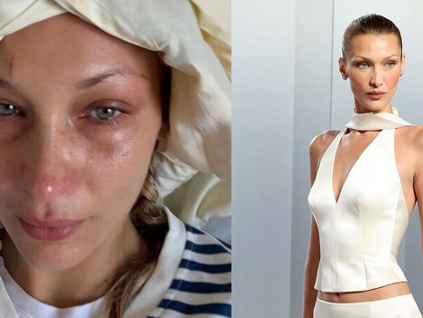 Bella Hadid, Lyme hastalığıyla mücadelesini anlattı