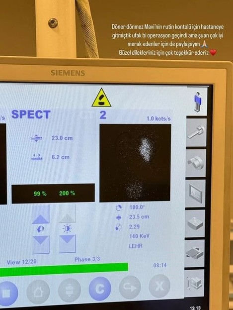 Hande Erçel'in yeğeni operasyon geçirdi! Gamze Erçel sağlık durumunu açıkladı - Resim : 2