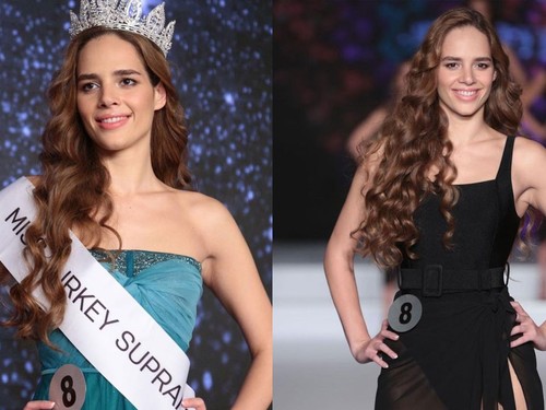 Miss Turkey üçüncüsü Selin Erberk Gurdikyan kimdir?