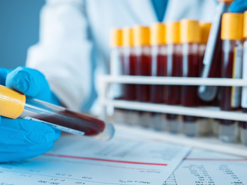 Japonlar kan grubuna bakıyor!