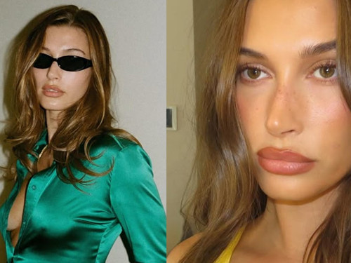 Hailey Bieber yüzüne yaptırdığı işlemleri açıkladı