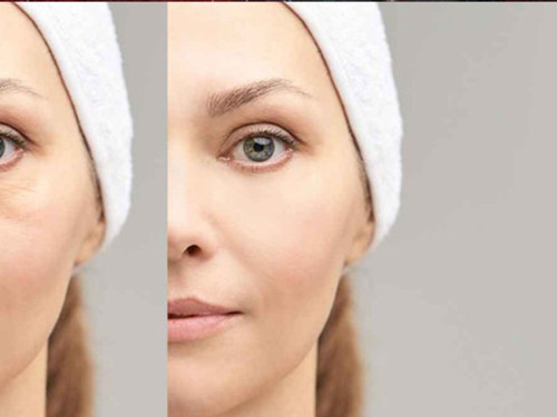 Doğru göz kremi seçmenin 5 püf noktası