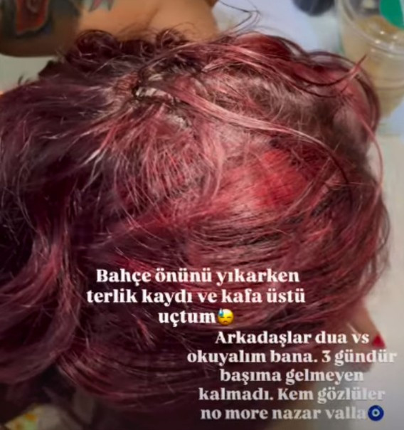 Melek Mosso tatilde kafa üstü düştü: "Sadece 3 santimle kurtuldum" - Resim : 1