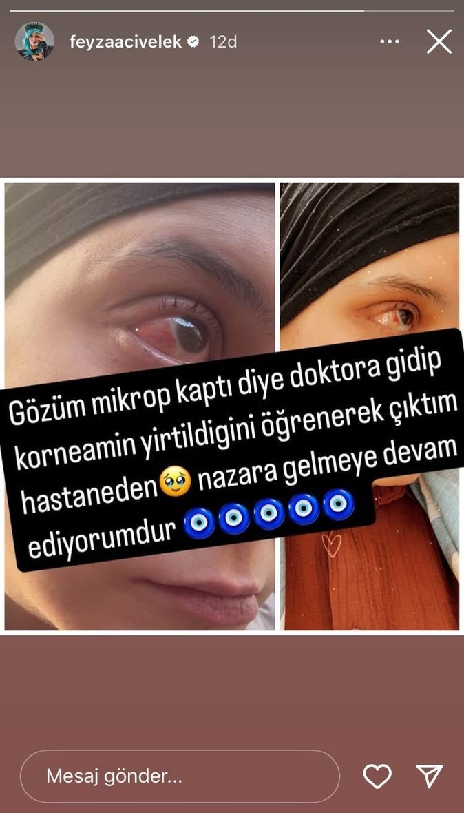 'Kızılcık Şerbeti'nin 'Nilay'ı Feyza Civelek'in korneası yırtıldı! - Resim : 3