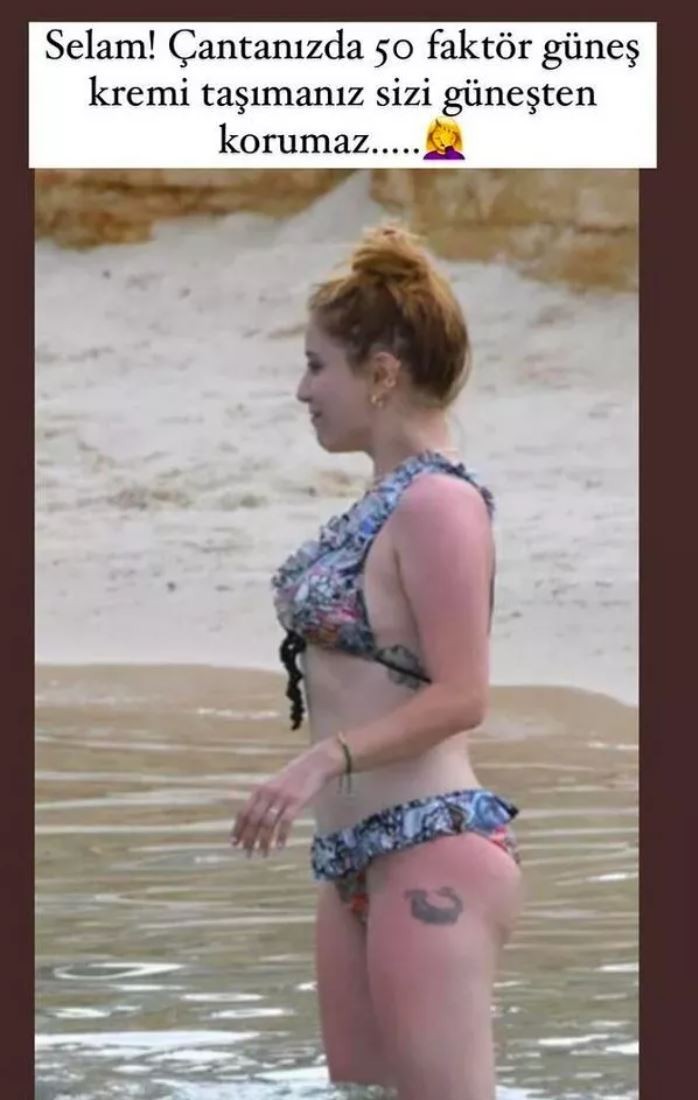 Hazal Kaya'nın güneş kremi ile imtihanı! ''Çantanızda 50 faktör güneş kremi taşımanız sizi güneşten korumaz'' - Resim : 1