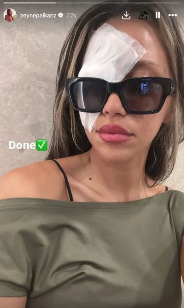 Zeynep Alkan gözünden ameliyat oldu - Resim : 1