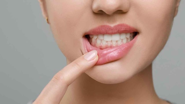 Diş eti çekilmesi nedir? Neden olur? Nasıl tedavi edilir? - Resim : 1
