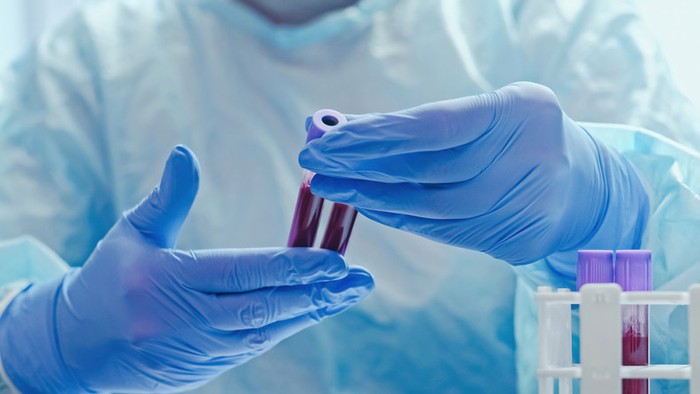 Ferritin nasıl yükseltilir? (Çocuklarda, emzirenlerde) Ferritini yükselten besinler neler? - Resim : 1