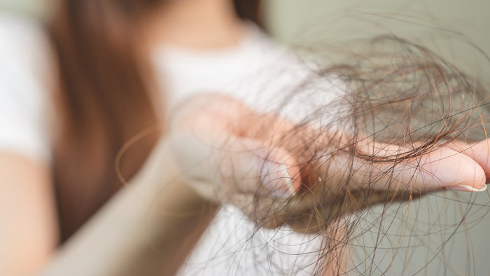 Şekerli içecekler saç dökülmesi riskini artırıyor! - Resim : 1