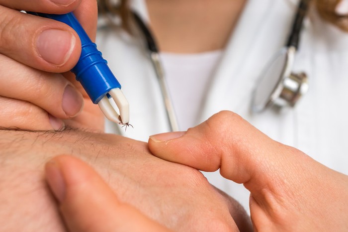 Lyme hastalığı nedir, belirtileri neler? Lyme hastalığı tedavisi nasıl olur? - Resim : 1