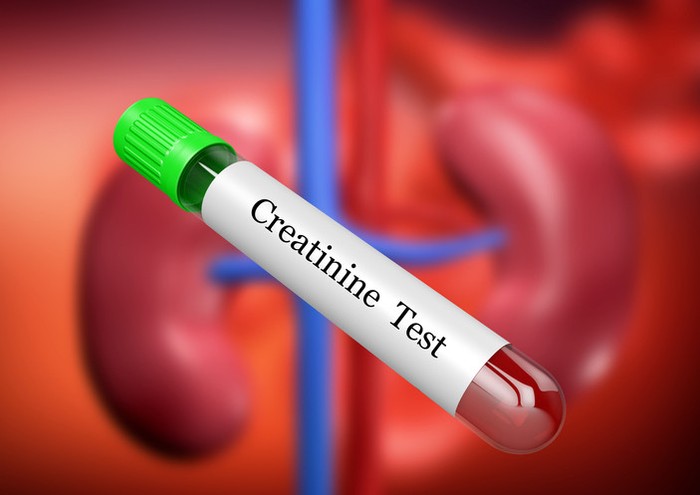 Kreatinin nedir? Kreatinin düşüklüğü ve yüksekliği ne anlama gelir? 6 soruda kreatinin - Resim : 1