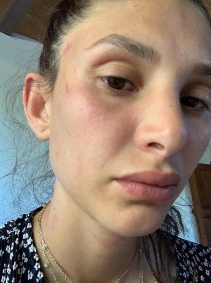 Can Yaman'ın sevgilisi Sara Bluma, çocuğunun babasından şiddet gördüğünü açıkladı - Resim : 2