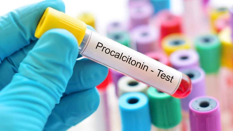 Prokalsitonin (PCT) nedir? Prokalsitonin neden bakılır? Prokalsitonin değeri kaç olmalı?