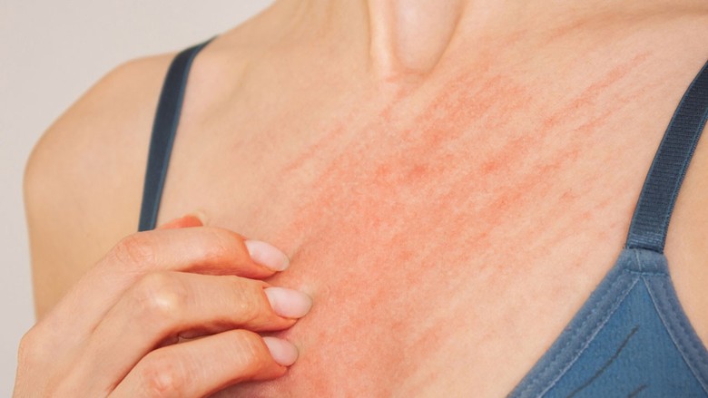 Uyuz belirtileri neler? Neden olur? Uyuz hastalığı nasıl bulaşır? 8 soruda uyuz hastalığı
