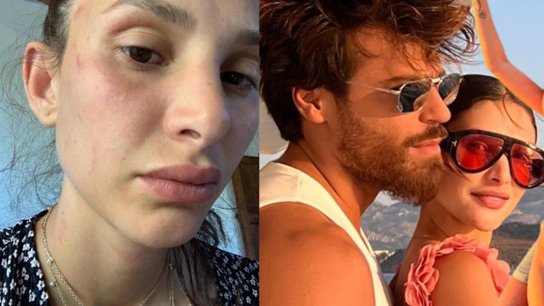Can Yaman'ın sevgilisi Sara Bluma, çocuğunun babasından şiddet gördüğünü açıkladı