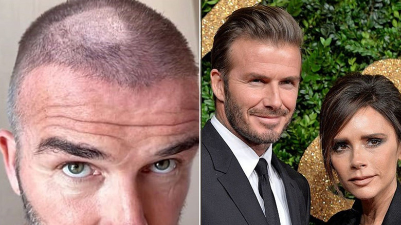 Victoria Beckham, David Beckham'ın tıraş kazasını paylaştı